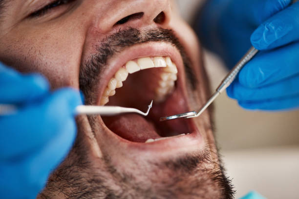 Best Urgent Care for Lost Fillings or Crowns in Des C, AR